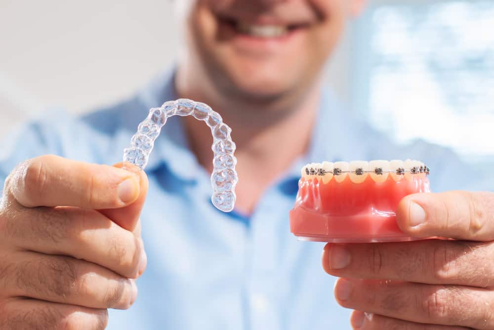 What Is Invisalign?